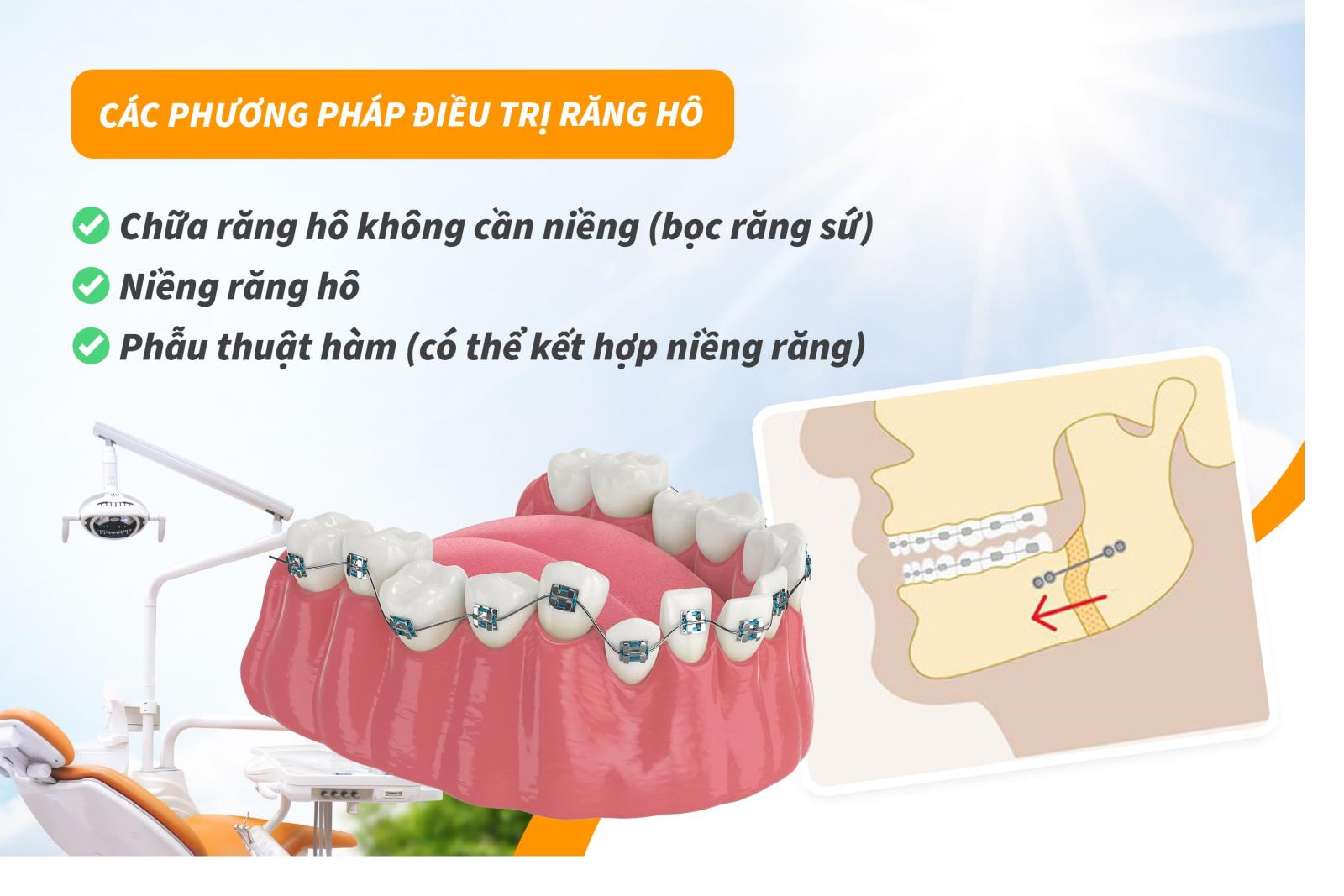 Các phương pháp điều trị răng hô