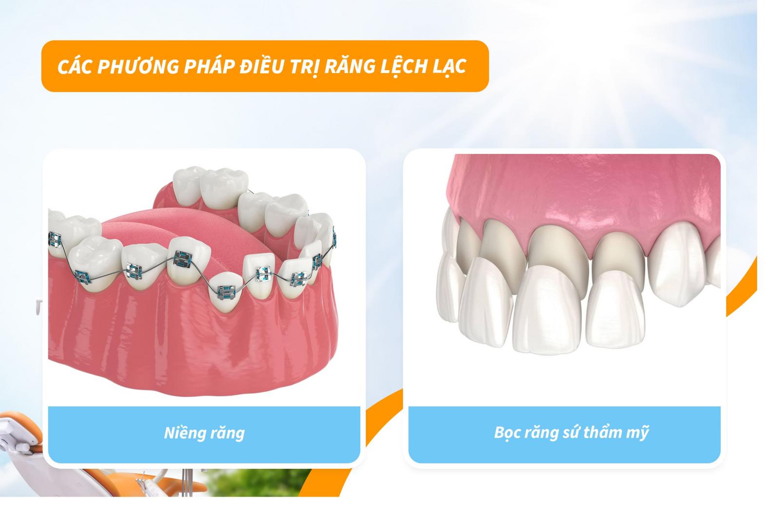 Các phương pháp điều trị răng lệch lạc