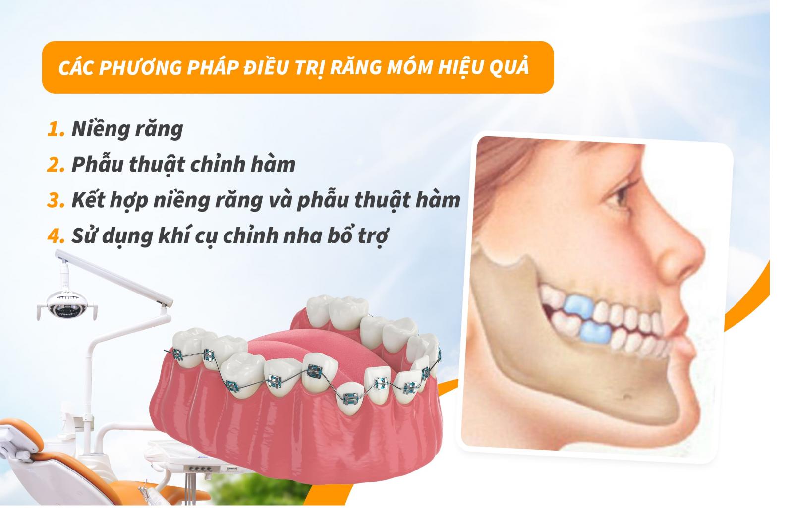 Các phương pháp điều trị răng móm hiệu quả