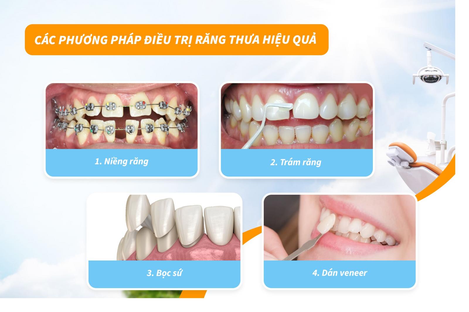 Các phương pháp điều trị răng thưa hiệu quả