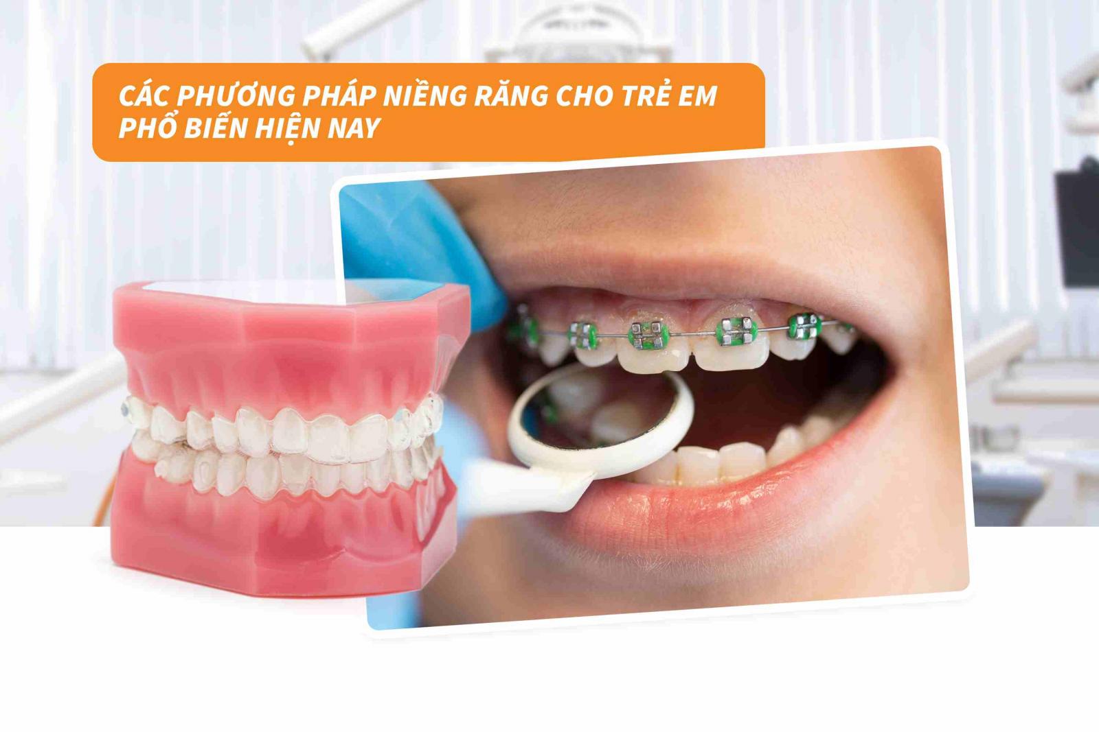 Các phương pháp niềng răng cho trẻ em