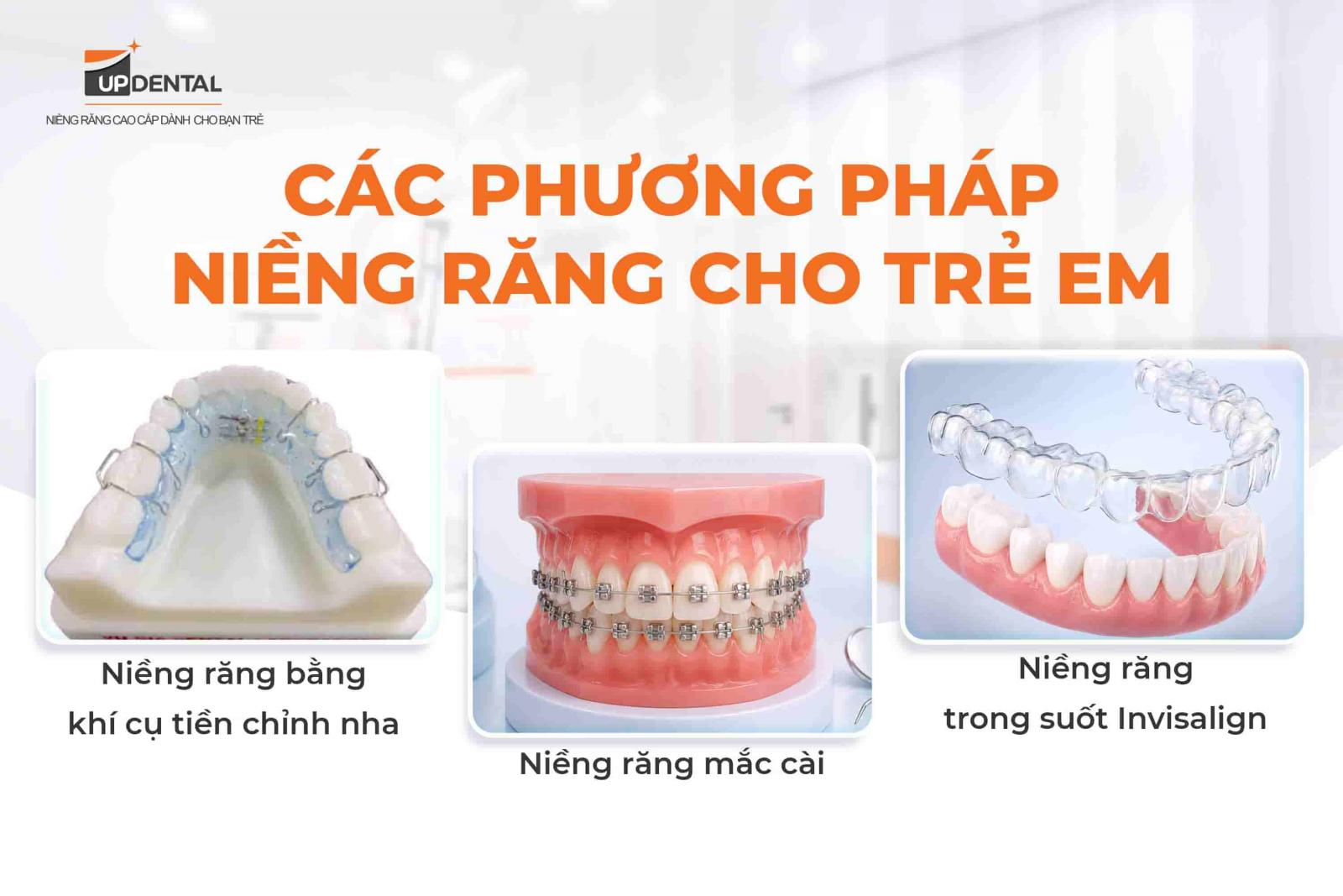 Các phương pháp niềng răng cho trẻ em