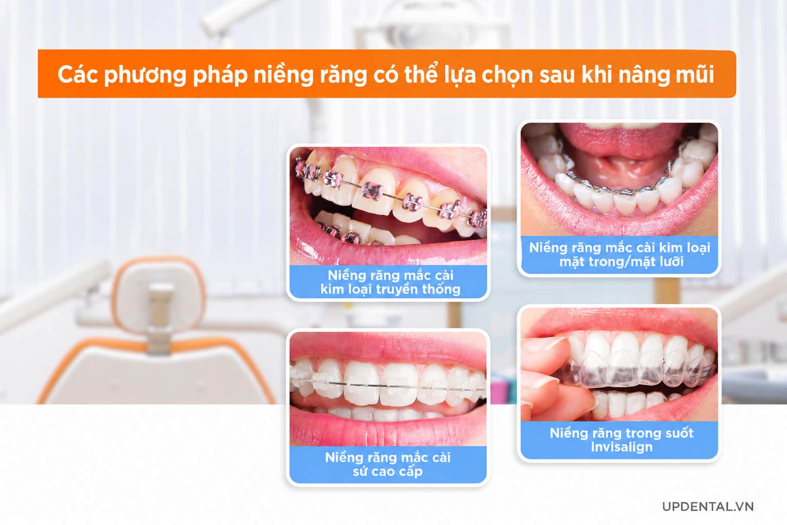 Phương pháp niềng răng nâng mũi