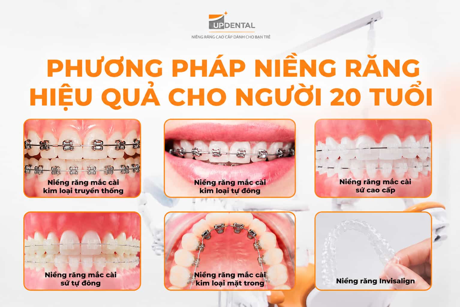 Các phương pháp niềng răng phù hợp với người 20 tuổi