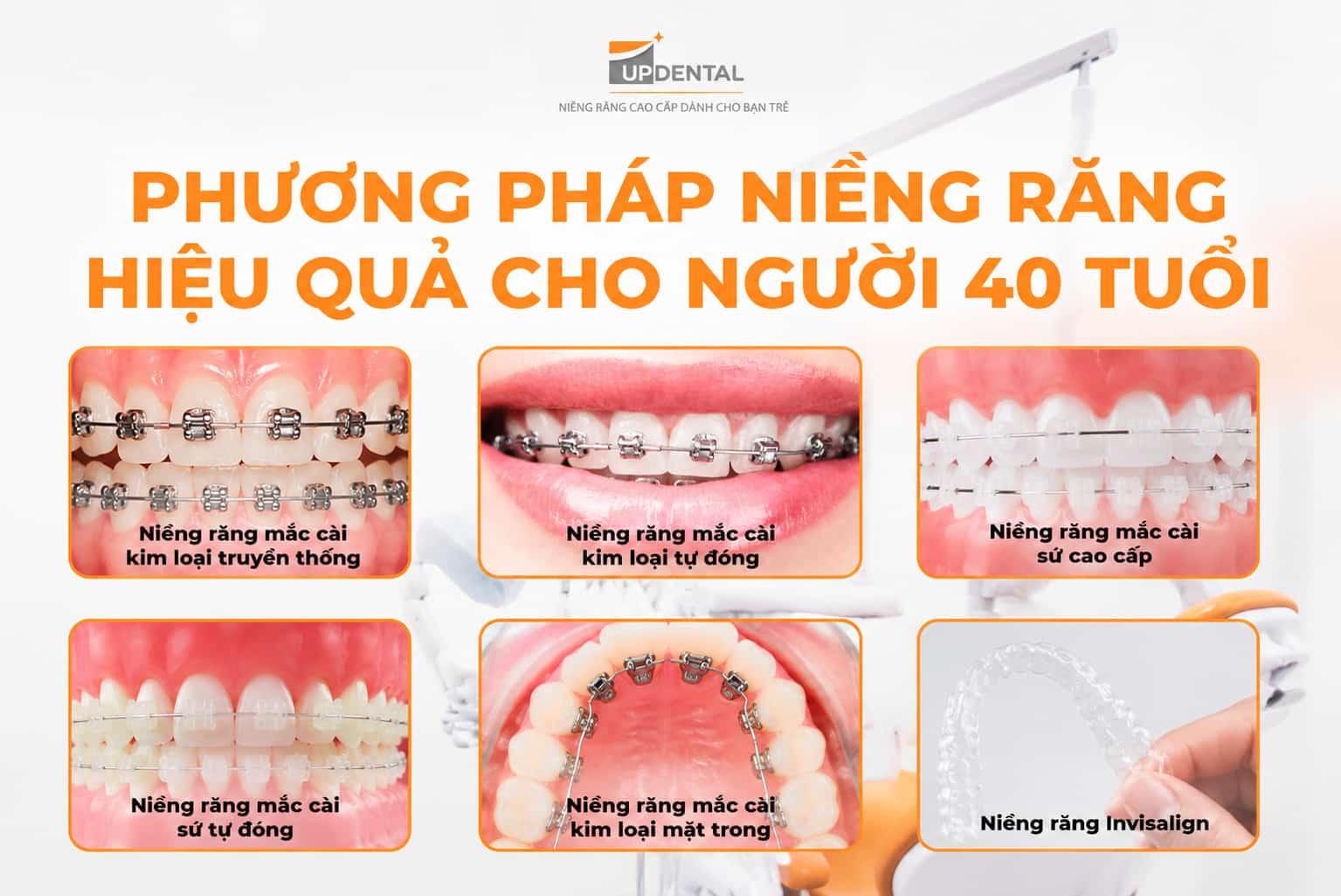 Phương pháp niềng răng hiệu quả cho người 40 tuổi