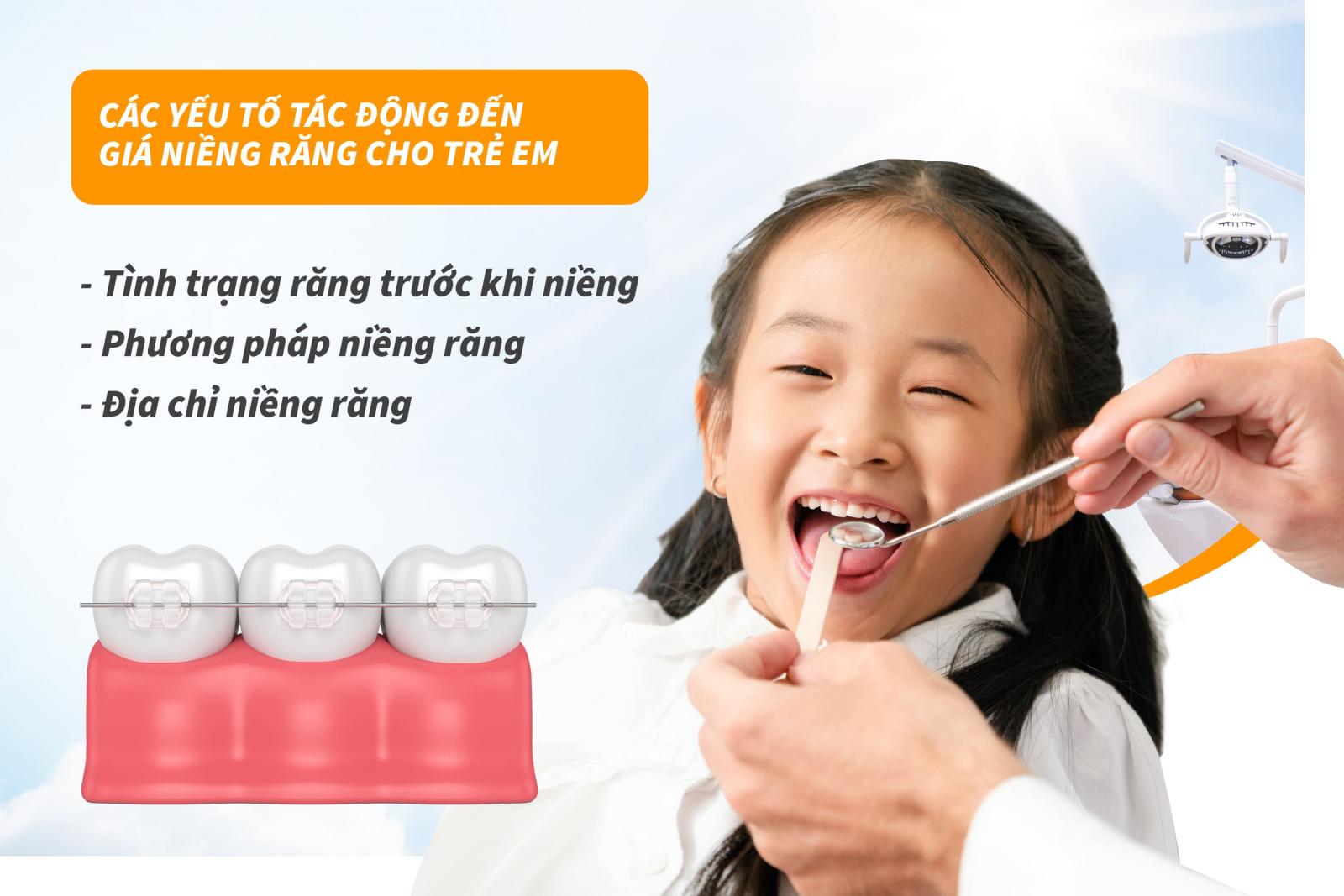 Các yếu tố tác động đến giá niềng răng cho trẻ em