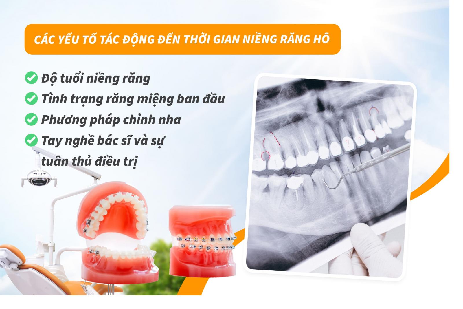 Các yếu tố tác động đến thời gian niềng răng