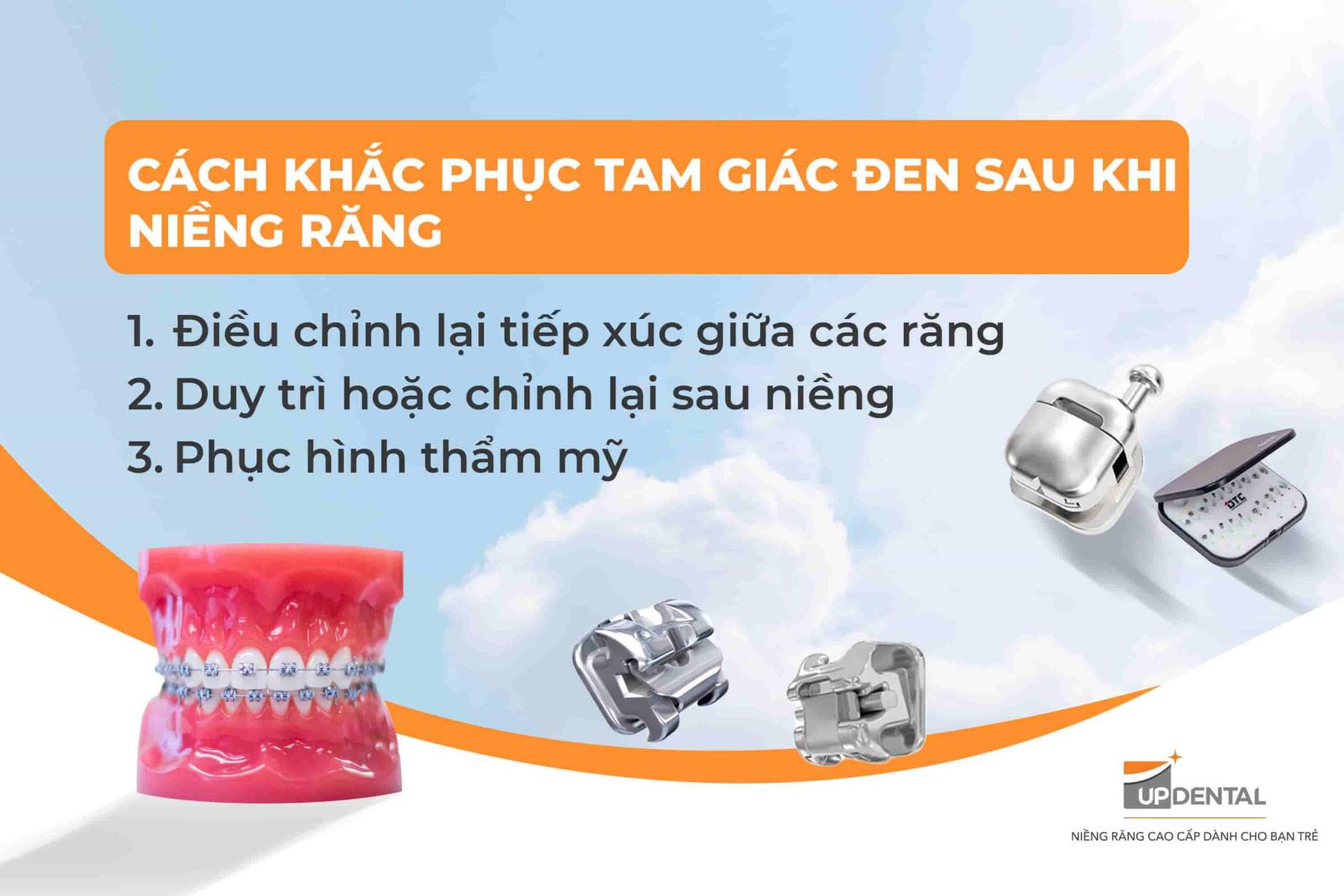 Cách khắc phục tam giác đen sau khi niềng răng