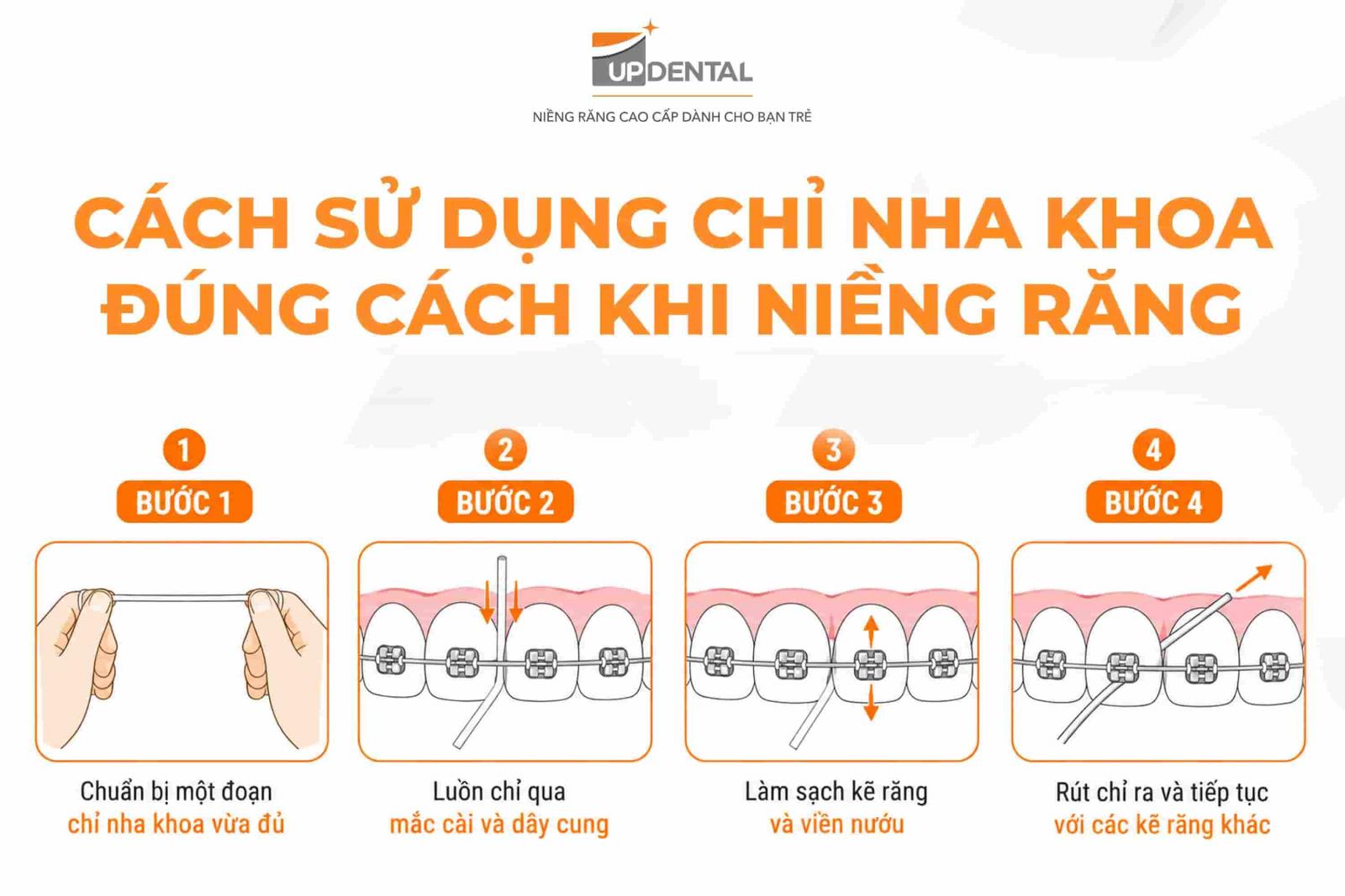 Cách sử dụng chỉ nha khoa đúng cách khi niềng răng