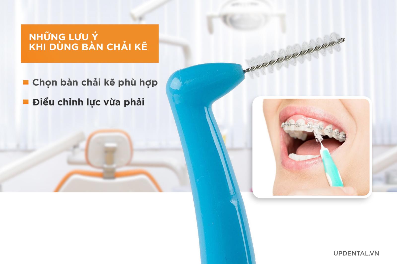 lưu ý khi sử dụng bàn chải kẽ cho người niềng răng