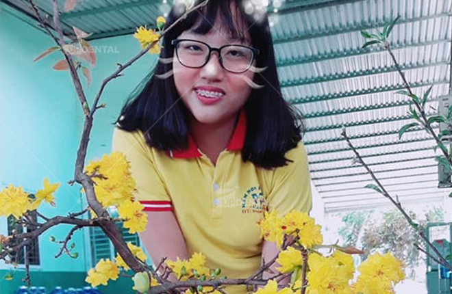 cai thien rang ho khi nieng