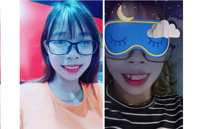 cai thien rang ho nho nieng rang