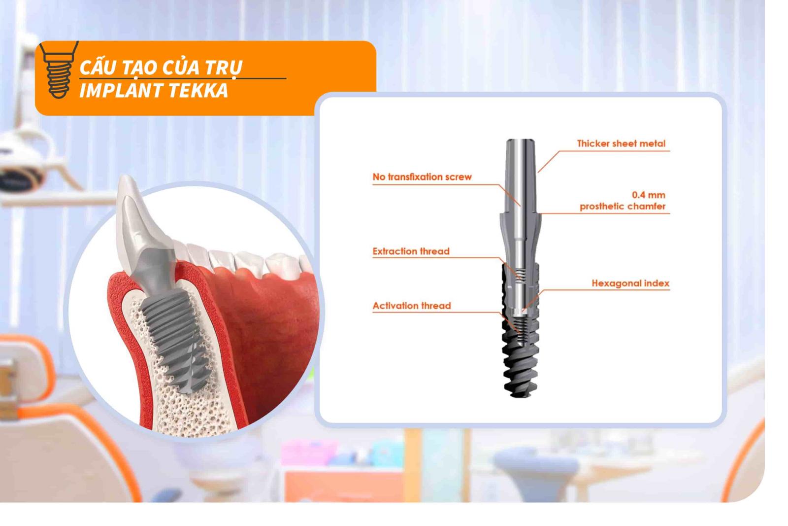 Trụ Implant Tekka