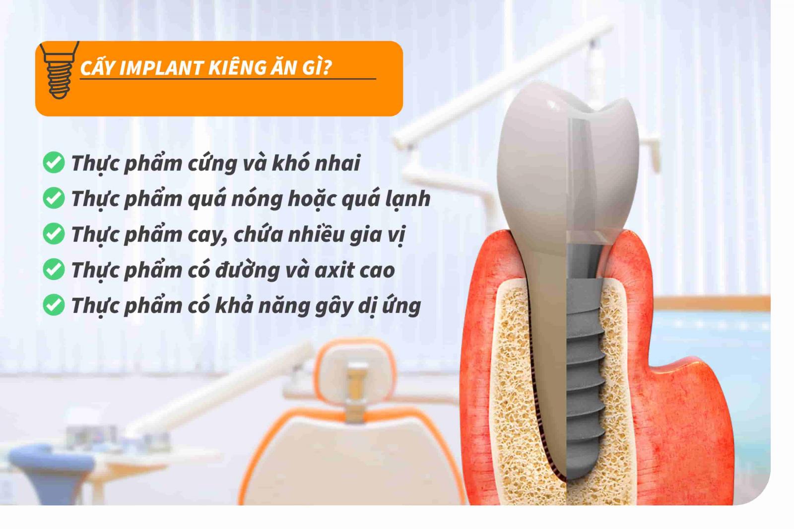Cấy Implant kiêng ăn gì?