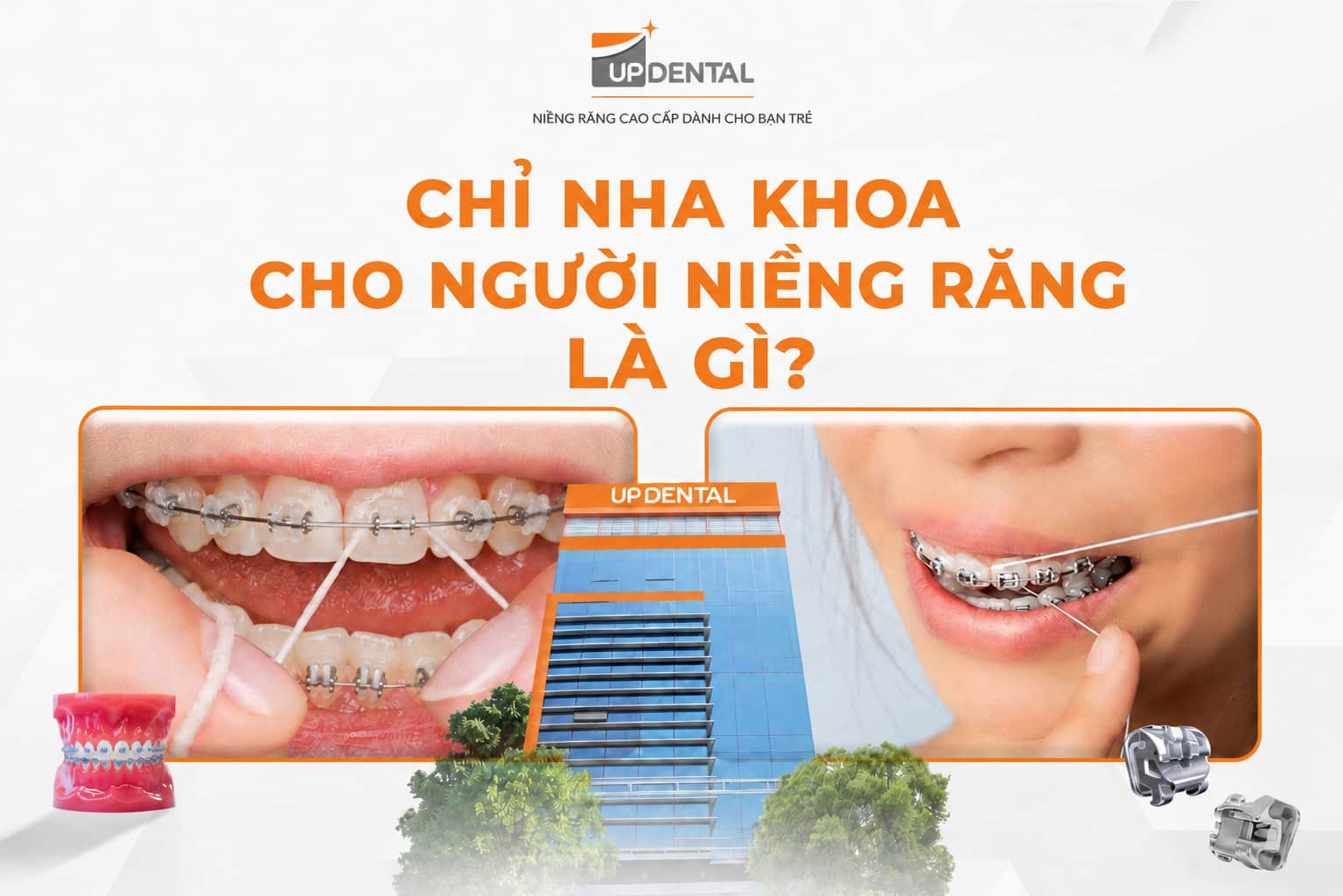 Chỉ nha khoa cho người niềng răng là gì?