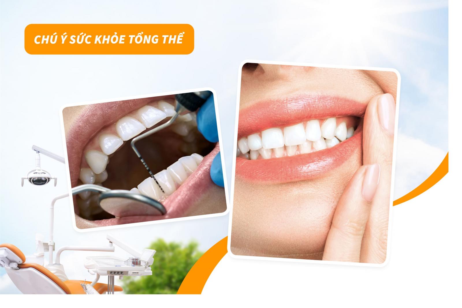 Chú ý sức khỏe tổng thể