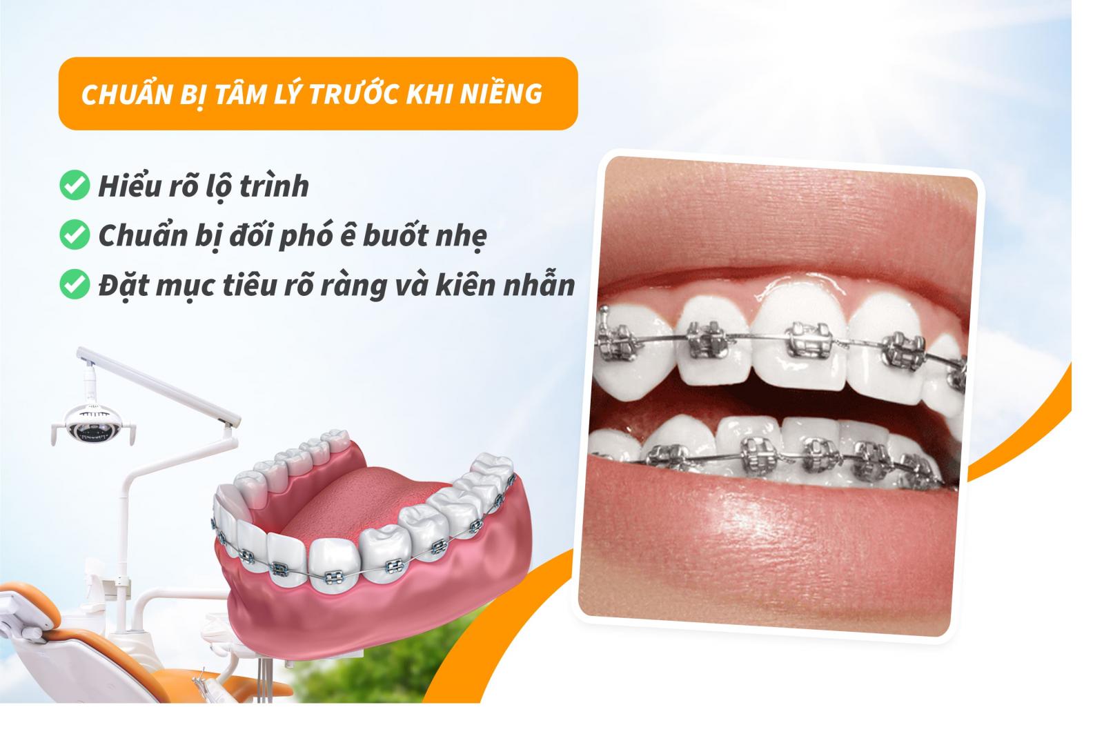Lưu ý khi niềng răng 5: Sẵn sàng về mặt tâm lý