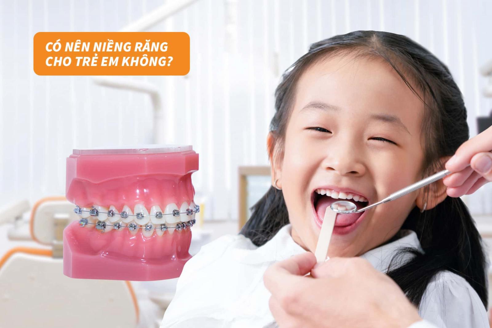 Có nên niềng răng cho trẻ em không?