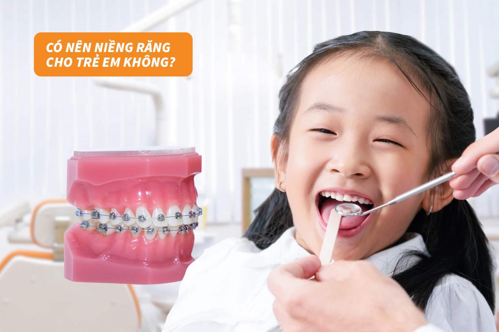Có nên niềng răng cho trẻ em?