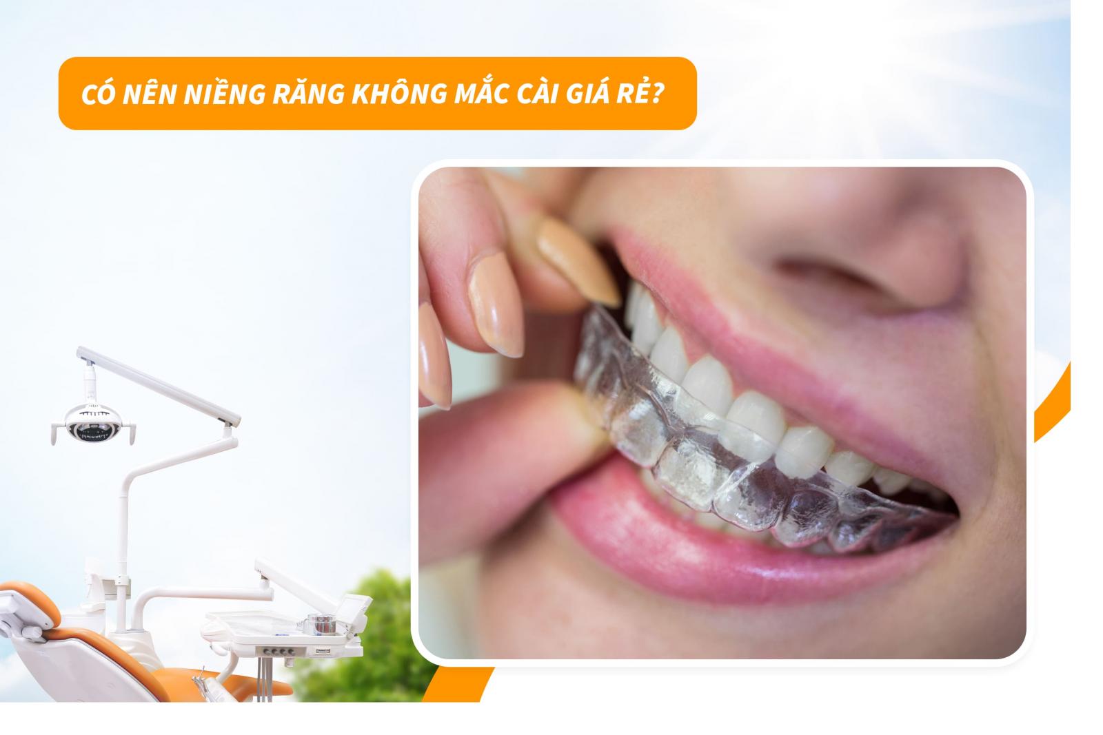 Có nên niềng răng không mắc cài giá rẻ?