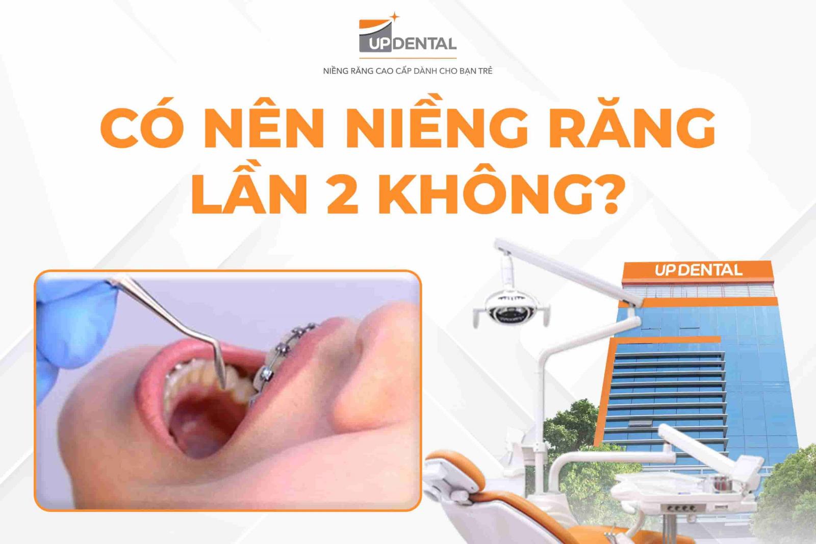 Có nên niềng răng lần 2 không?