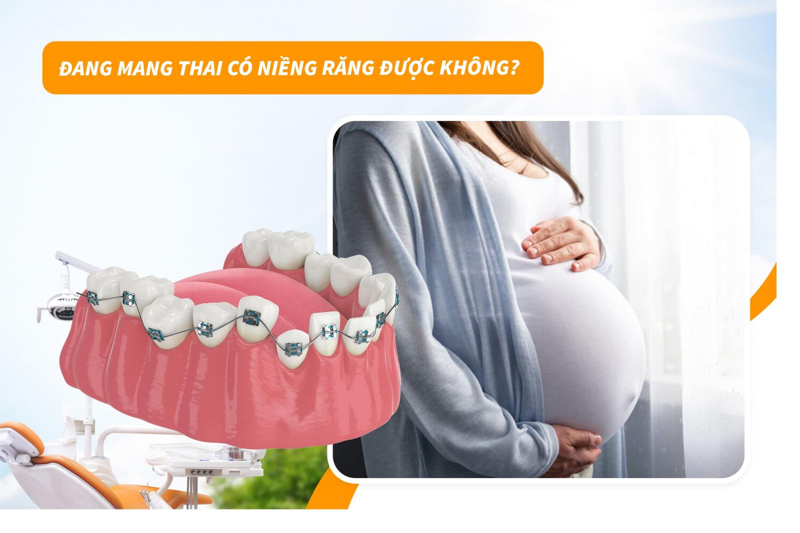 Đang mang thai có niềng răng được không?