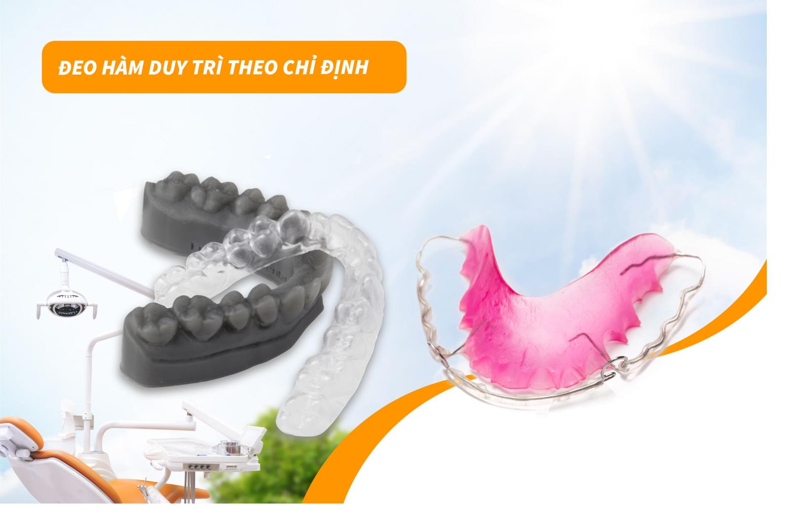 Lưu ý khi niềng răng 10: Đeo hàm duy trì theo chỉ định