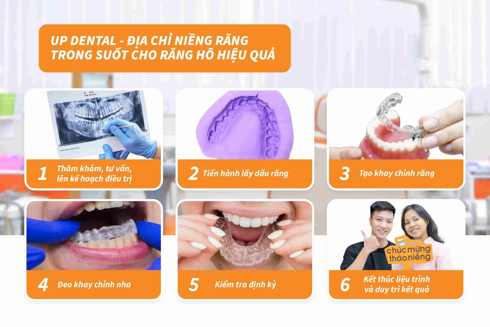 Up Dental - Địa chỉ niềng răng trong suốt cho răng hô hiệu quả