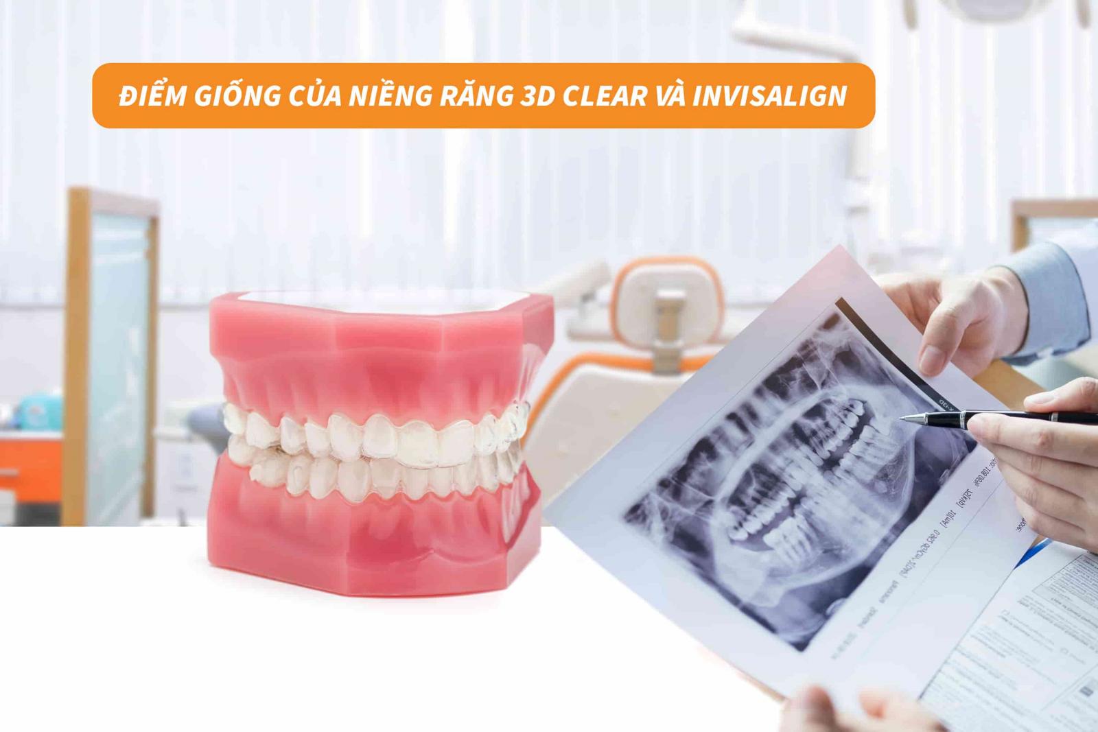 Điểm giống của niềng răng 3D Clear và Invisalign