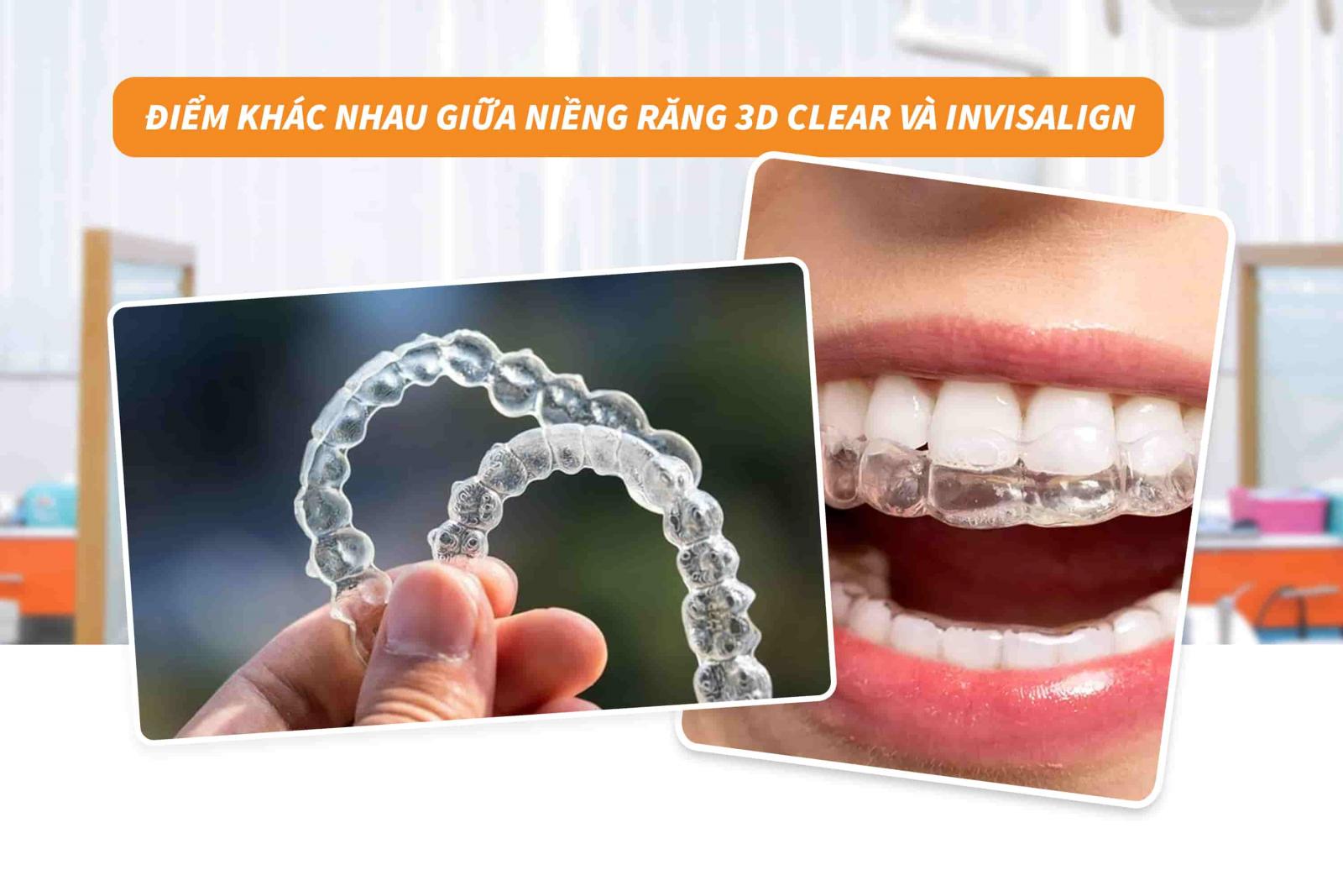 Điểm khác nhau giữa niềng răng 3D Clear và Invisalign