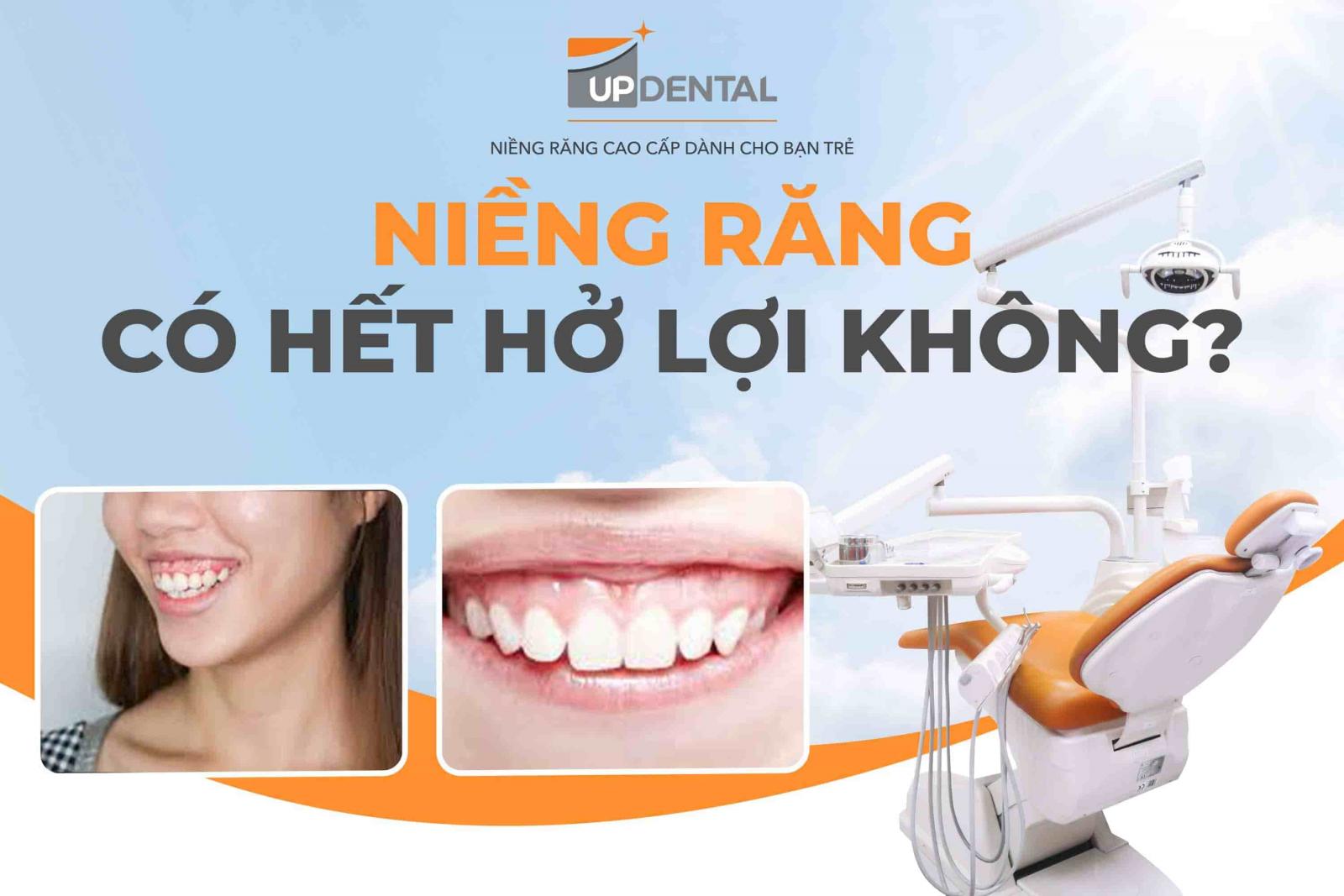 Niềng răng có hết hở lợi không?