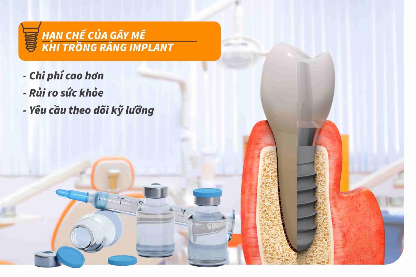 Hạn chế của gây mê khi trồng răng Implant