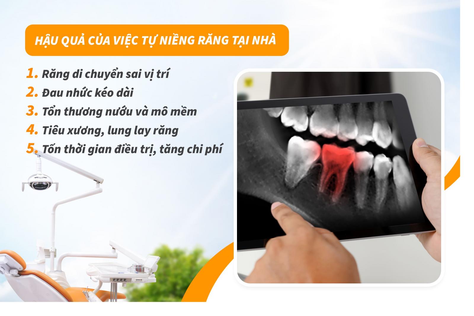 Hậu quả của việc tự niềng răng tại nhà