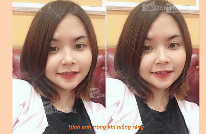 hinh anh nieng rang hien tai cua kim ngan