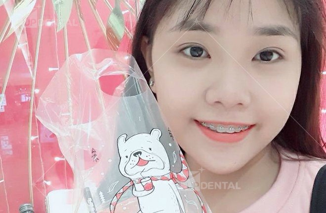 hinh anh khi nieng rang