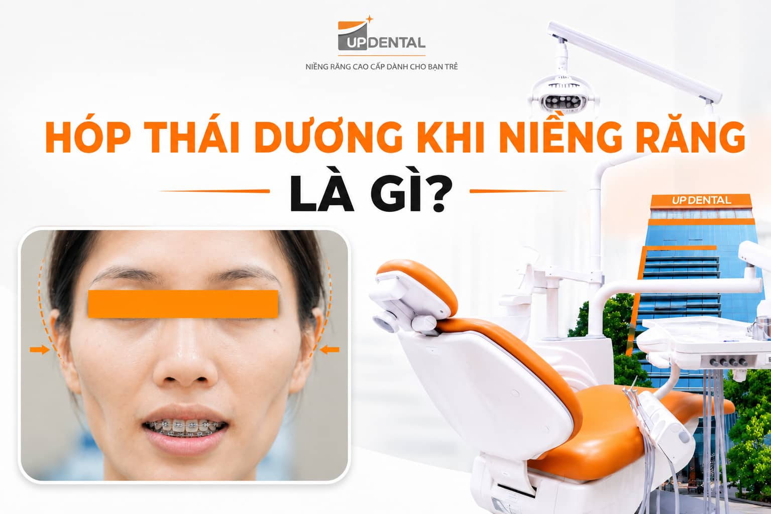 Hóp thái dương khi niềng răng là gì?