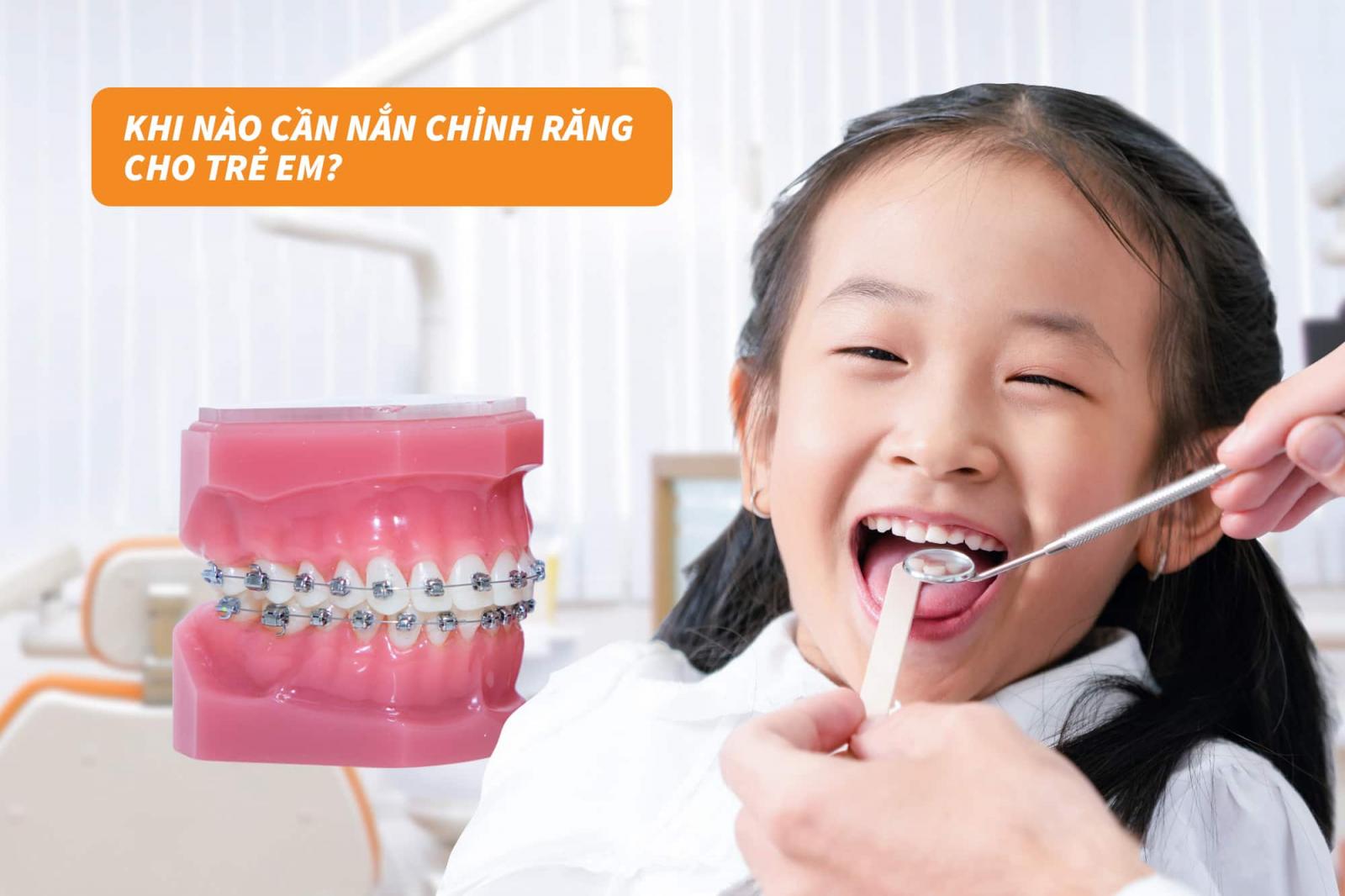 Khi nào cần nắn chỉnh răng cho trẻ em?