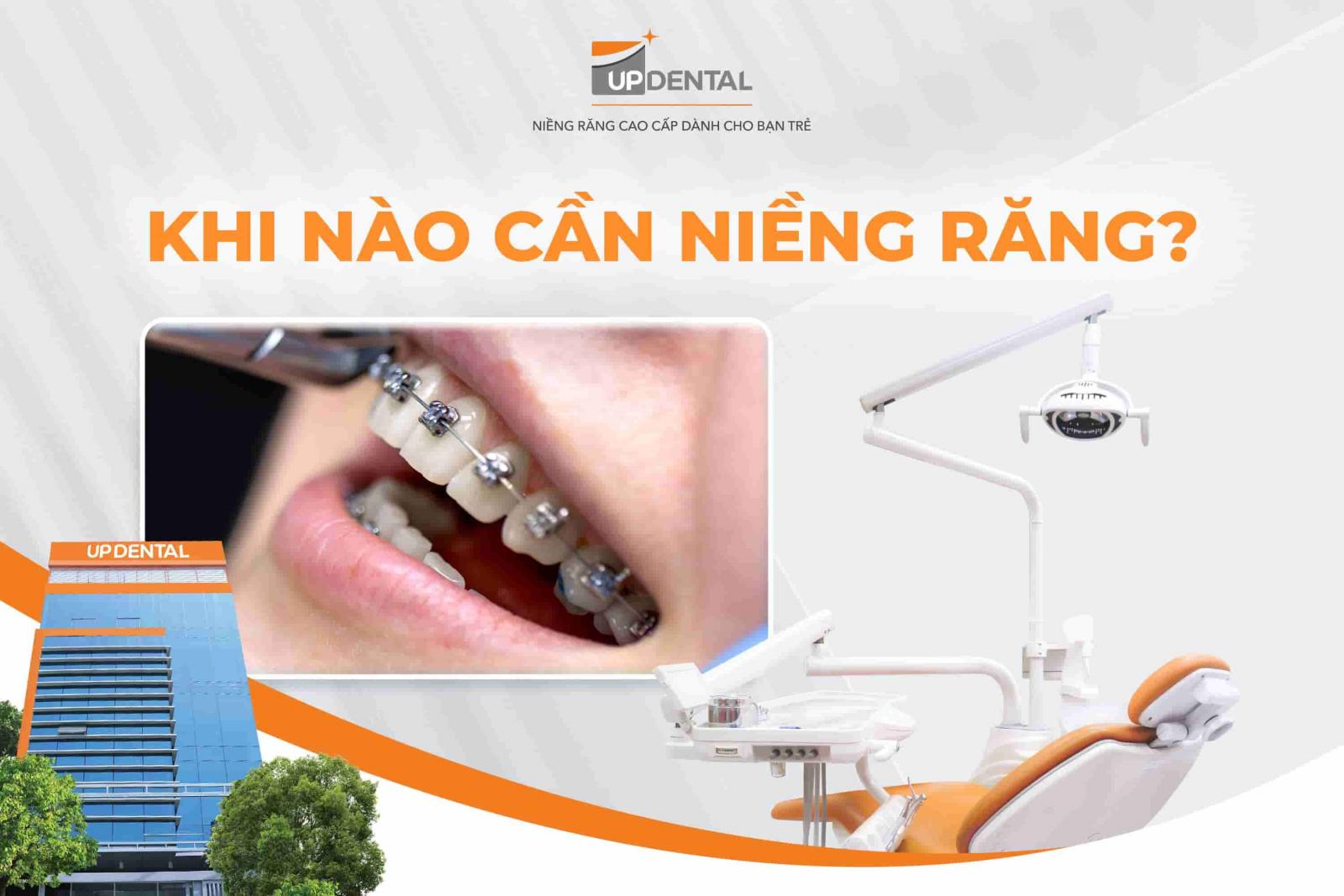 Khi nào cần niềng răng?