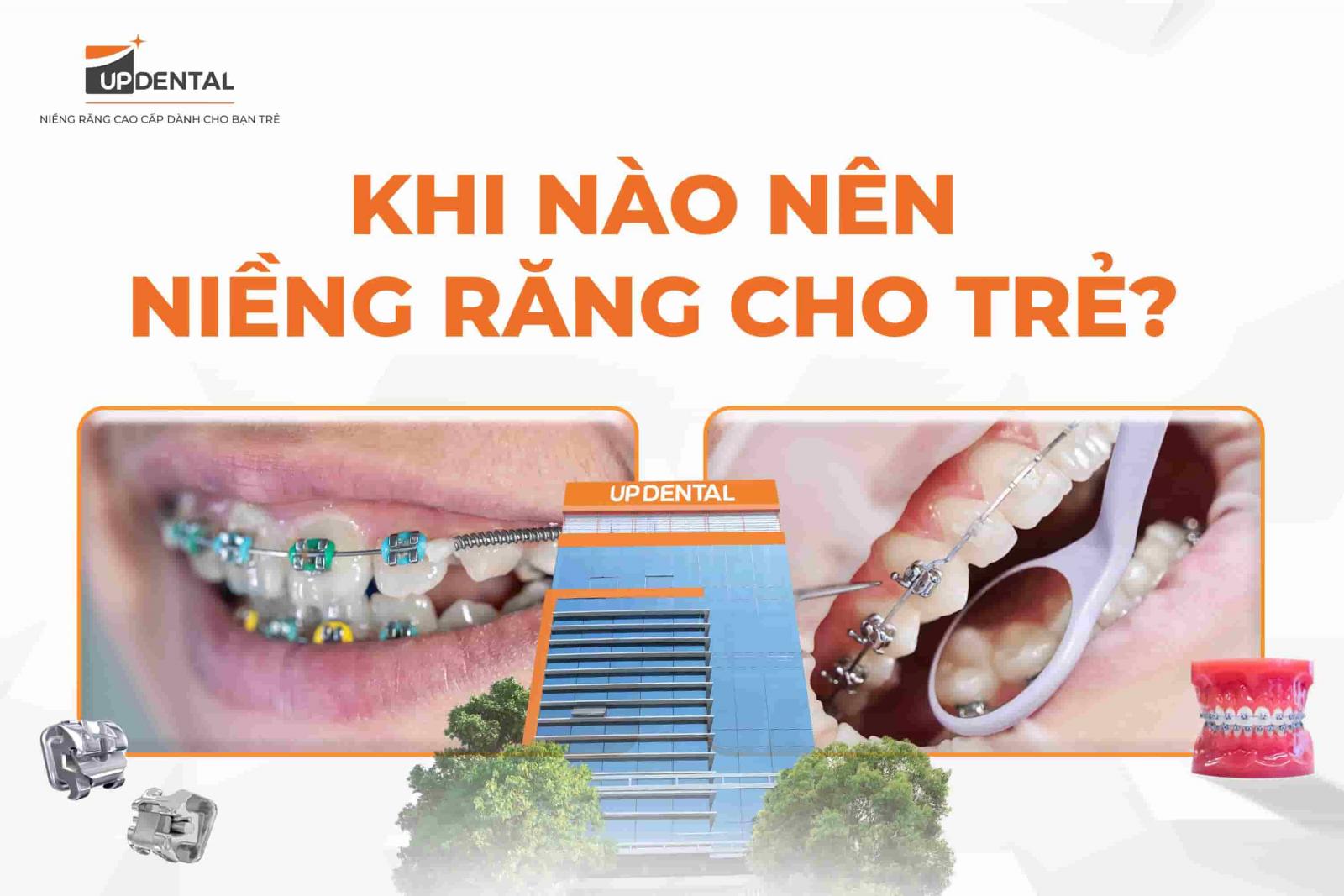 Khi nào nên niềng răng cho trẻ?