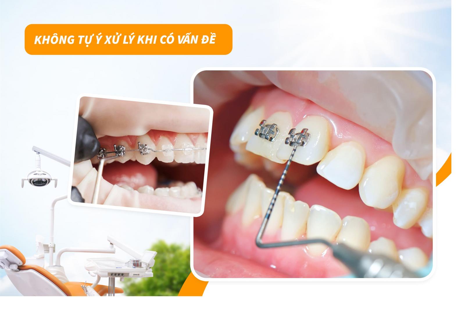 Không tự ý xử lý khi có vấn đề