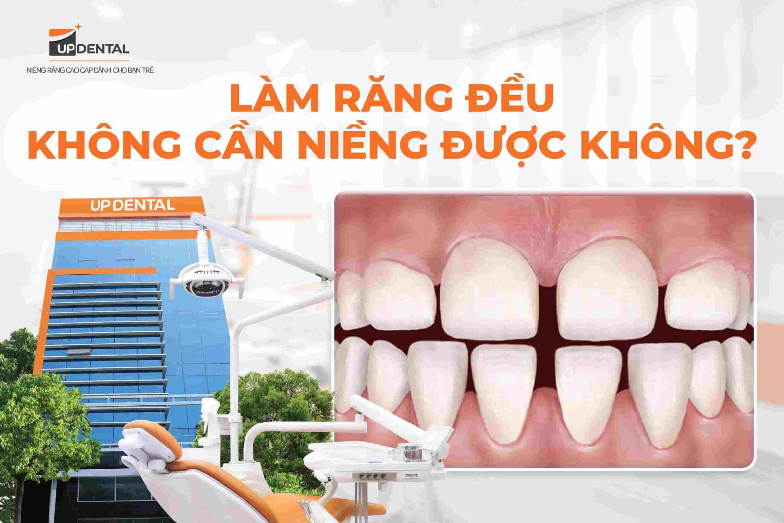 Làm răng đều không cần niềng được không?