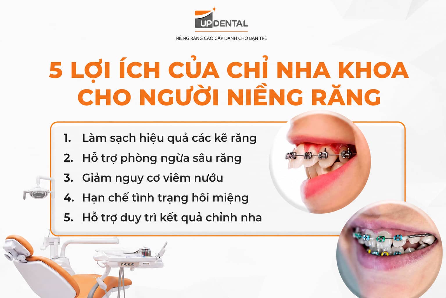 5 lợi ích của chỉ nha khoa cho người niềng răng