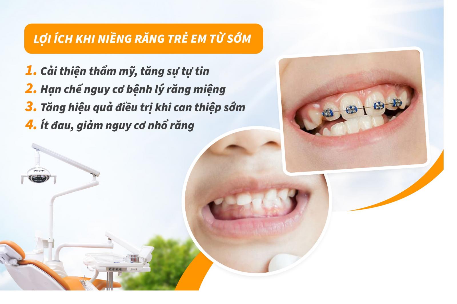Lợi ích khi niềng răng trẻ em từ sớm