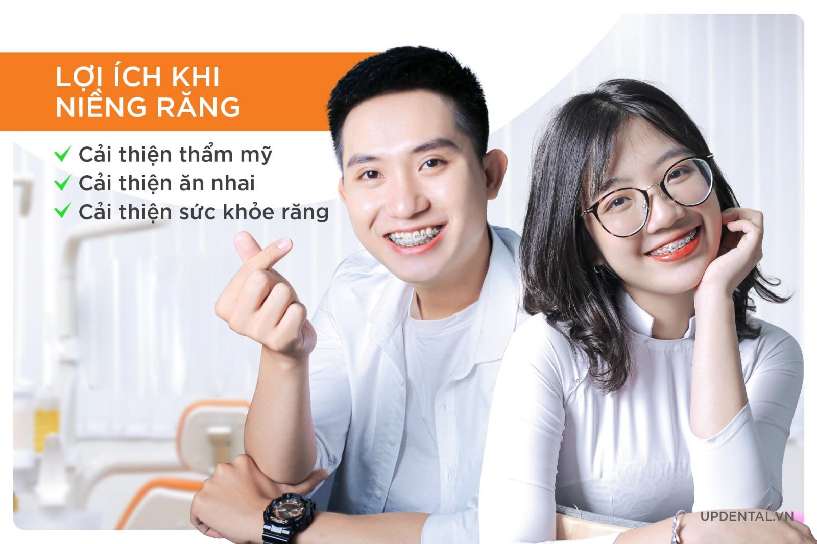 lợi ích niềng răng