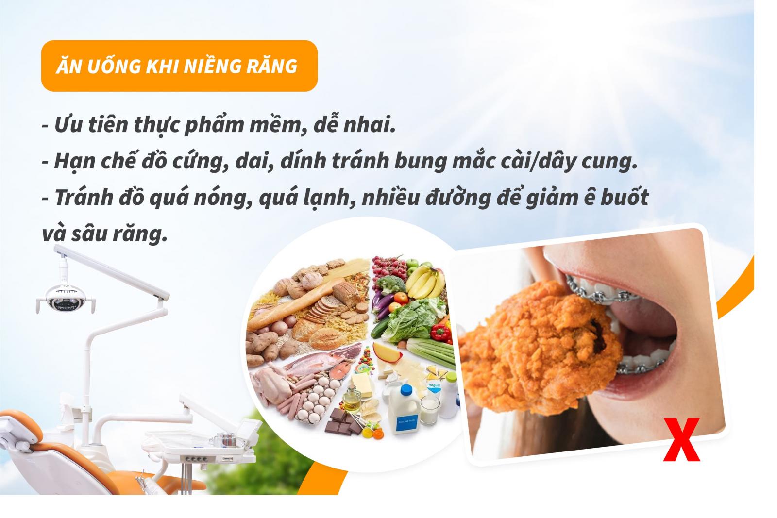 Lưu ý khi niềng răng 7: Ăn uống