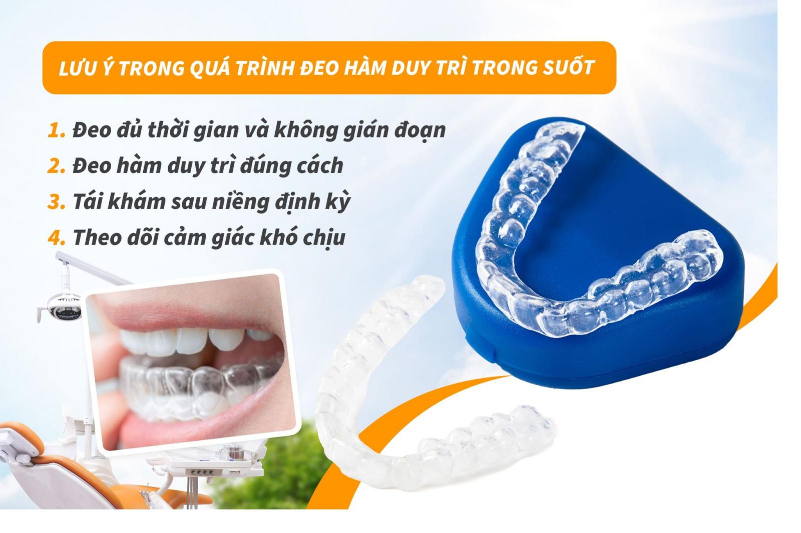 Lưu ý trong quá trình đeo hàm duy trì trong suốt