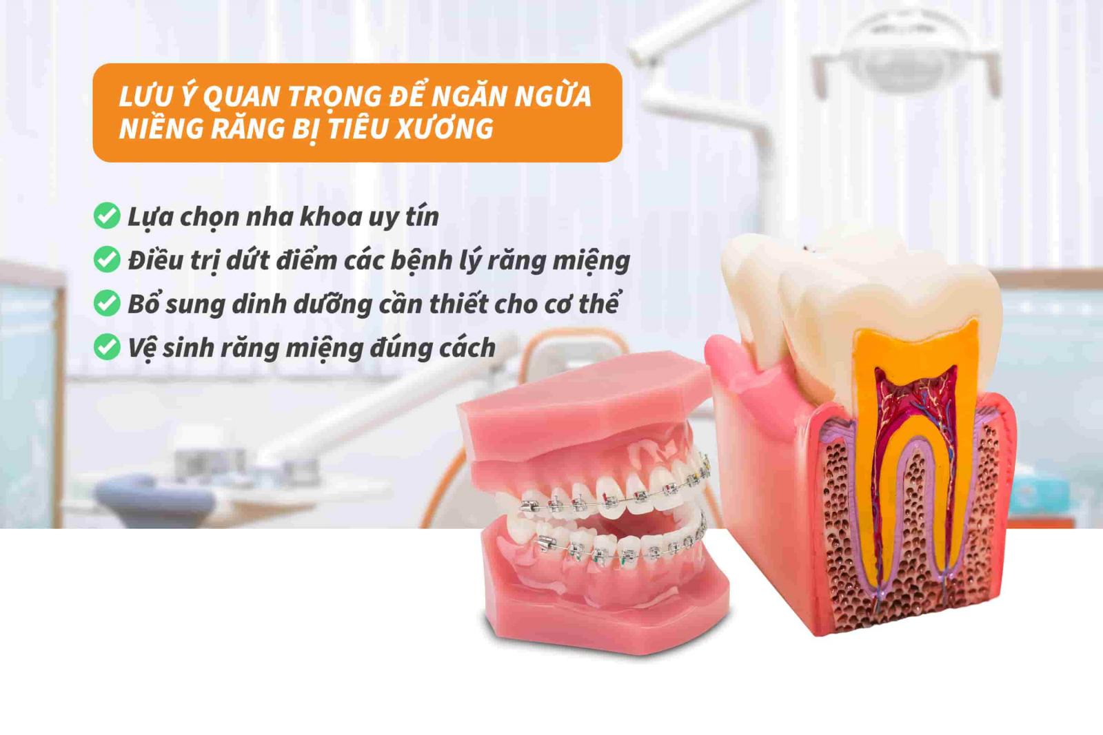 Lưu ý quan trọng để ngăn ngừa niềng răng bị tiêu xương