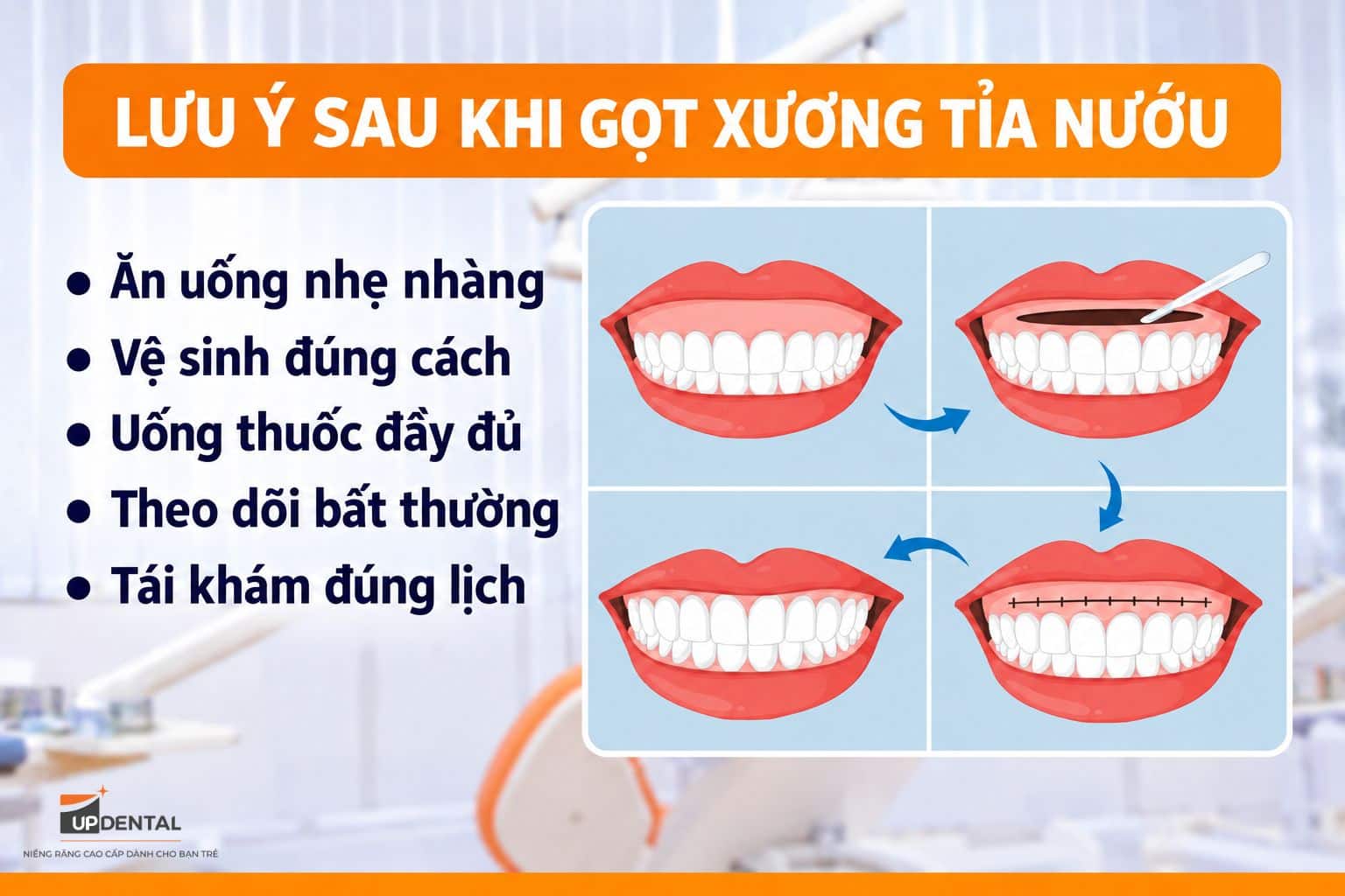 Cần lưu ý sau khi gọt xương tỉa nướu