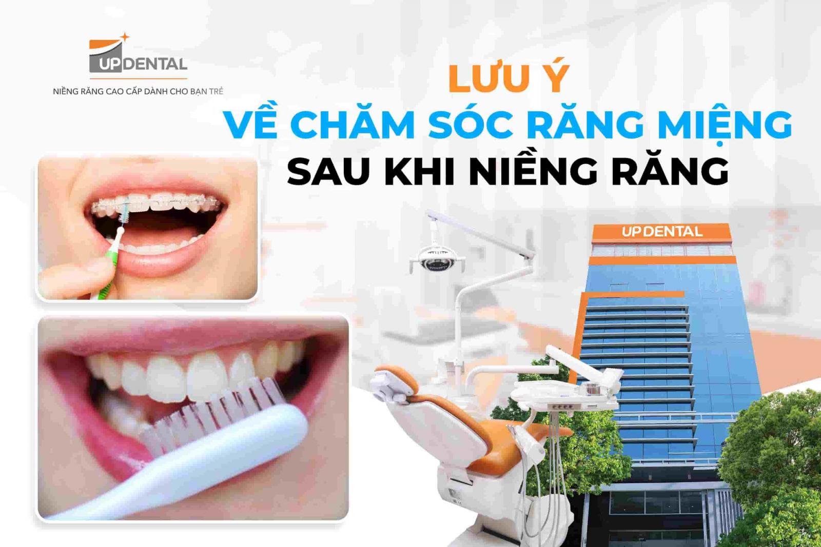 Lưu ý về chăm sóc răng miệng sau khi niềng răng