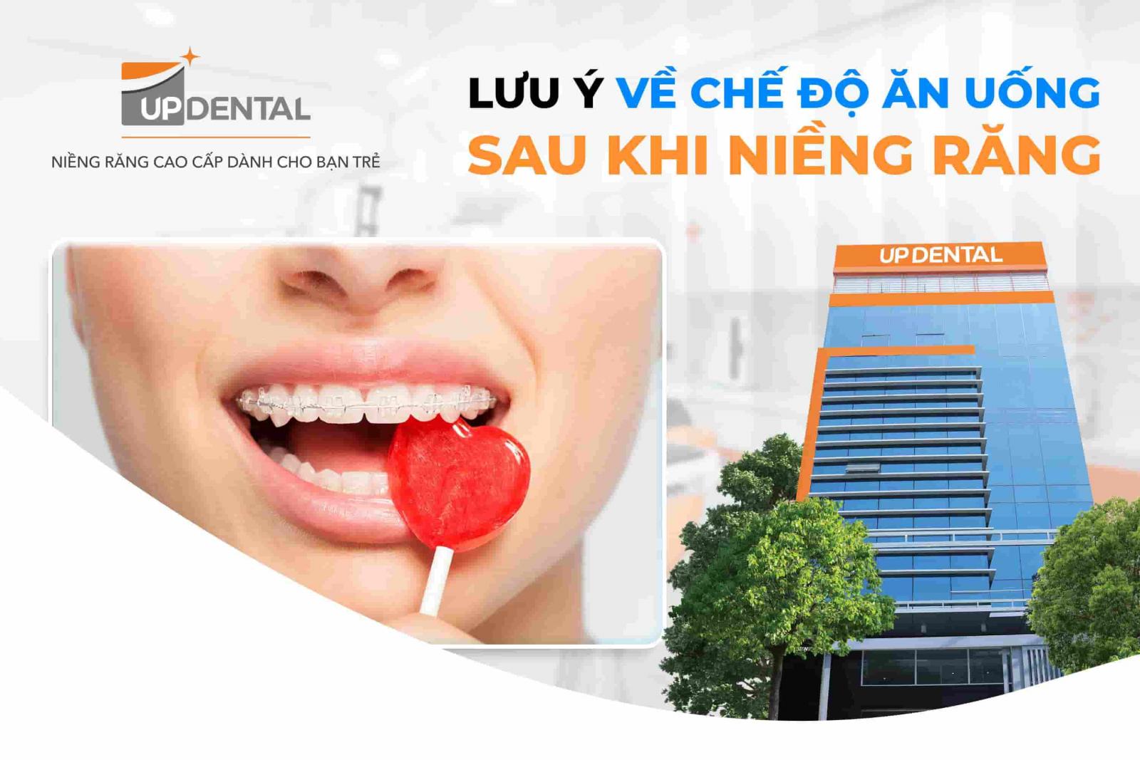 Lưu ý về chế độ ăn uống sau khi niềng răng